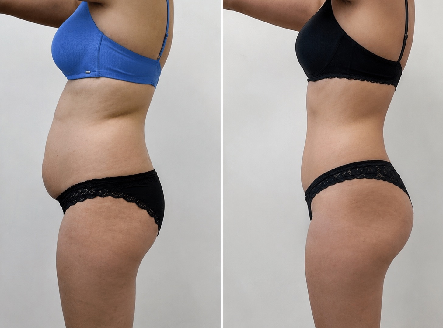 Client before and after body transformation